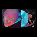 Fontaines D.C. | Dopamine Chamber (Indie Exclusive Blue Marble Vinyl)